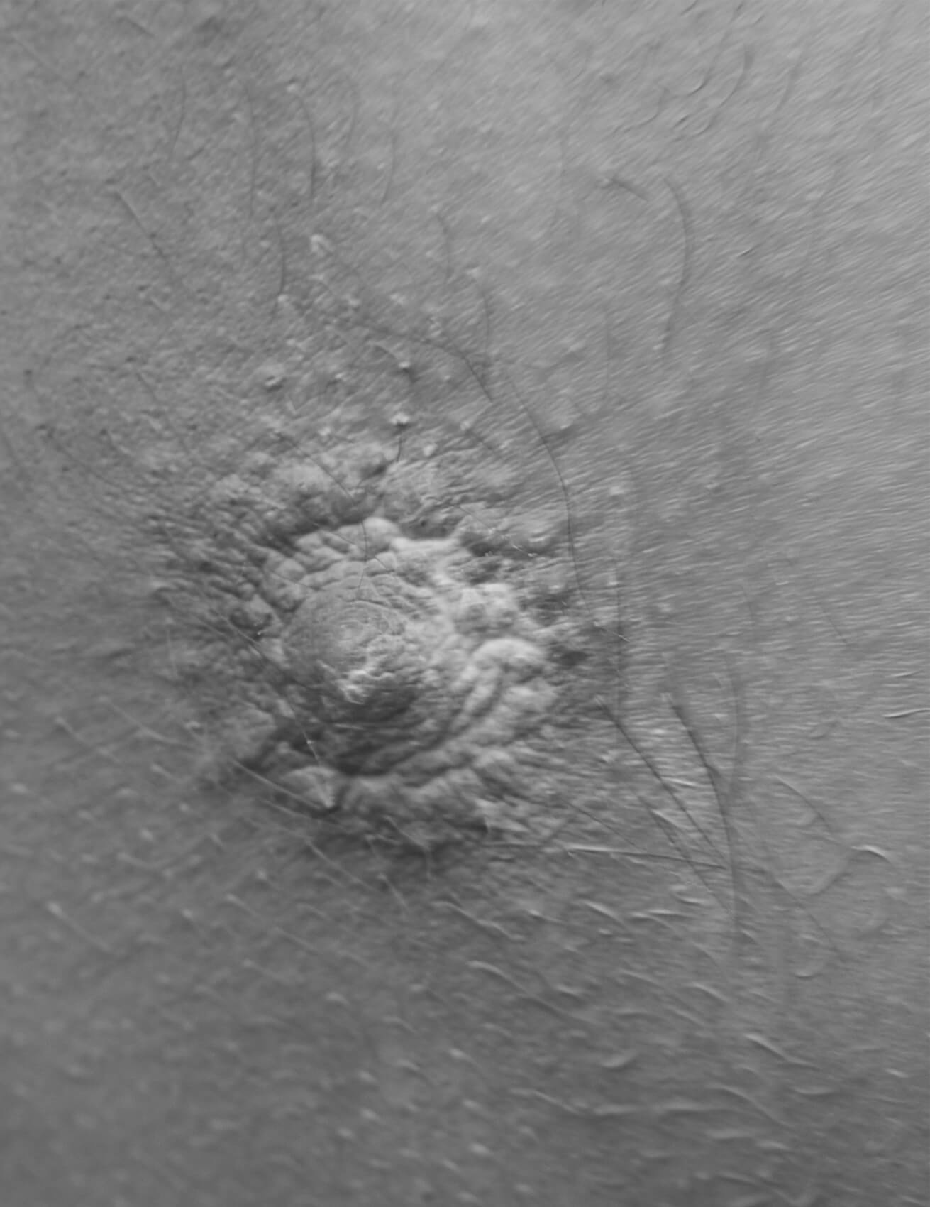 0035-4